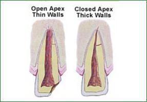 Injuries in children